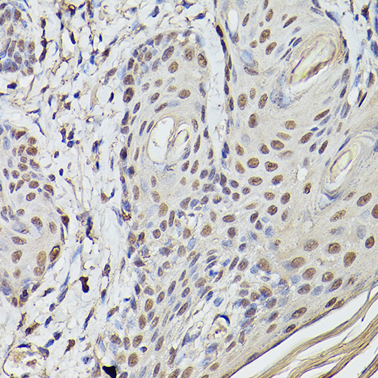 Anti-Pea3 / ETV4 Antibody (CAB5797)