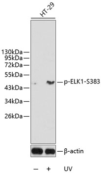 Anti-Phospho-ELK1-S383 Antibody (CABP0345)