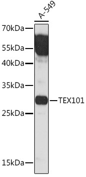 Anti-TEX101 Antibody (CAB18118)