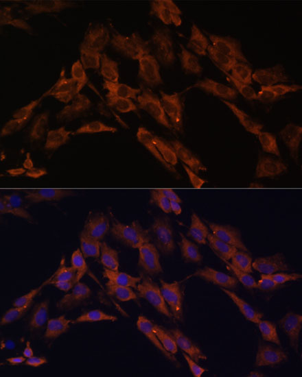 Anti-ENOX2 Antibody (CAB7063)