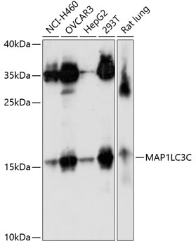 Anti-MAP1LC3C Polyclonal Antibody (CAB8295)