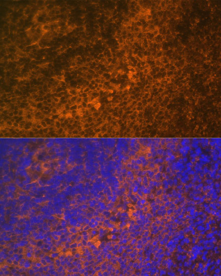 Anti-TNFRSF10A Antibody (CAB12540)