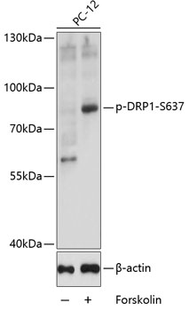 Anti-Phospho-DNM1L-S637 pAb (CABP0812)