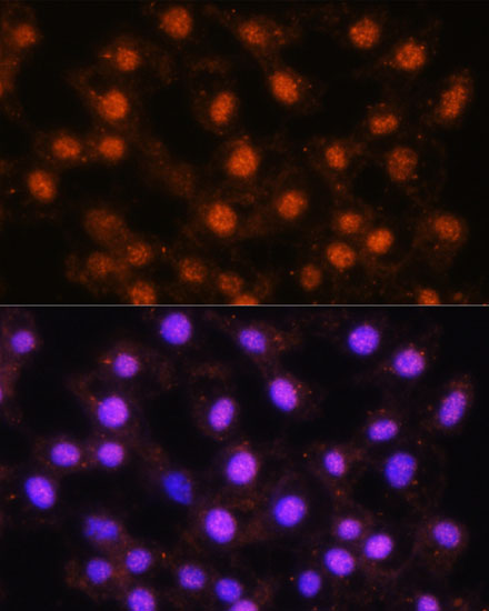 Anti-USP18 Antibody (CAB16739)