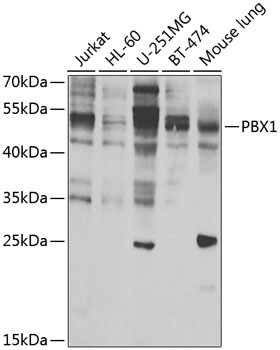 Anti-PBX1 Antibody (CAB7567)