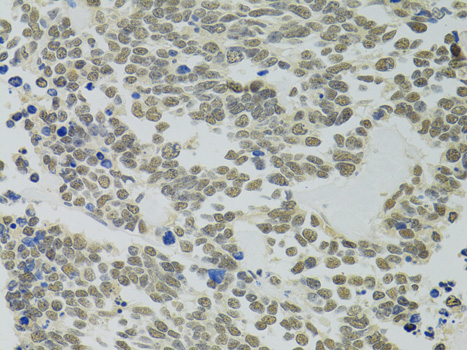 Anti-PPP4C Antibody (CAB2109)