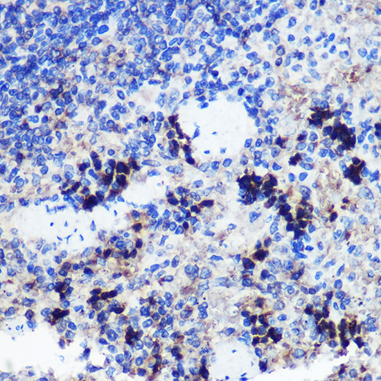 Anti-FCHSD1 Antibody (CAB15543)