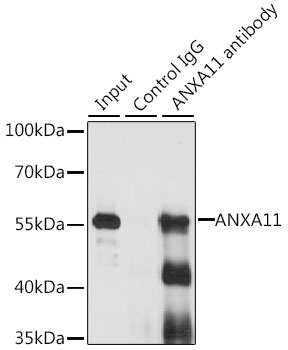 Anti-ANXA11 Antibody (CAB7423)