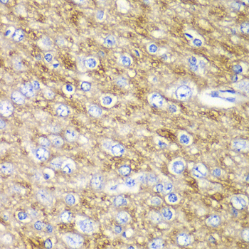 Anti-ARFGAP1 Antibody (CAB12595)