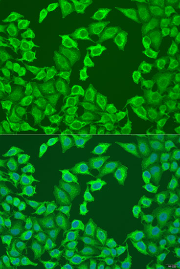 Anti-NCAPH Antibody (CAB15141)