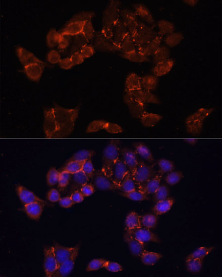 Anti-FKBP5 Antibody (CAB3863)