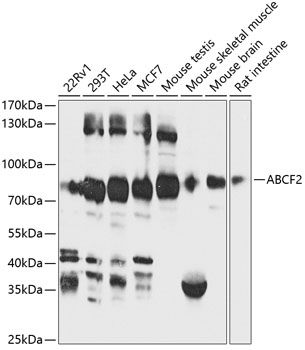 Anti-ABCF2 Antibody (CAB12555)