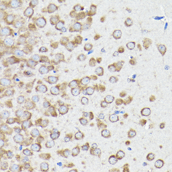 Anti-EEF1A1 Antibody (CAB17857)