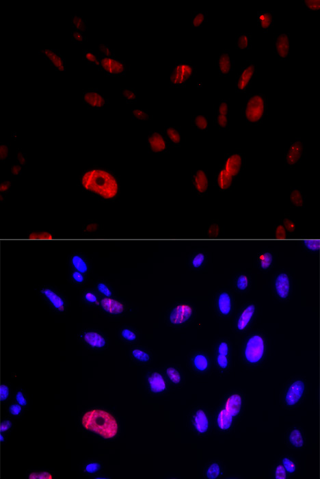 Anti-HUS1 Antibody (CAB5407)