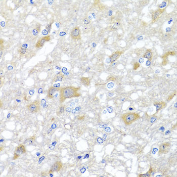 Anti-INPP5K Antibody (CAB7807)