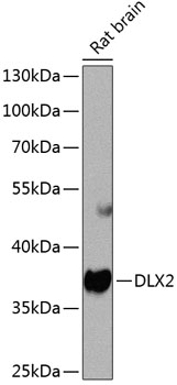 Anti-DLX2 Polyclonal Antibody (CAB8410)