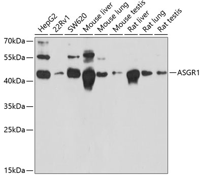 Anti-ASGR1 Antibody (CAB13279)