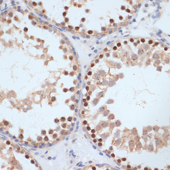 Anti-Phospho-BRCA1-S1423 Antibody (CABP0232)