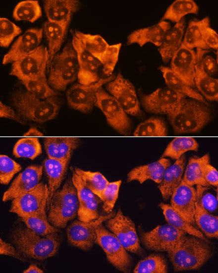 Anti-RPS3 Antibody (CAB2533)