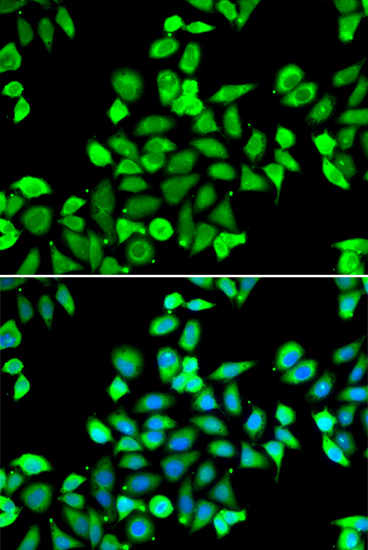 Anti-CDC16 Antibody (CAB7197)