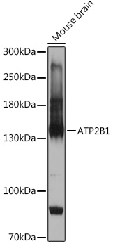 Anti-ATP2B1 Antibody (CAB18688)