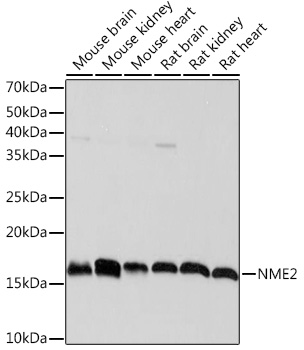 Anti-NME2 Antibody (CAB5621)