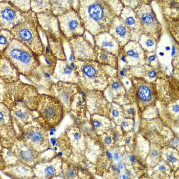 Anti-ASGR1 Antibody (CAB6871)