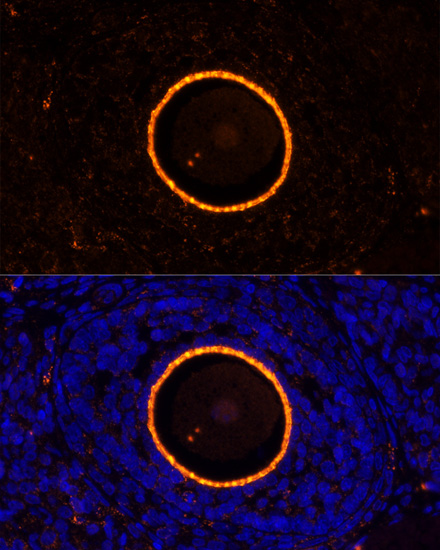 Anti-ZP2 Antibody (CAB10126)