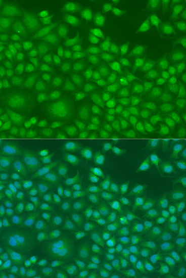 Anti-Ninein Polyclonal Antibody (CAB8215)