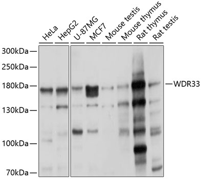 Anti-WDR33 Polyclonal Antibody (CAB9531)