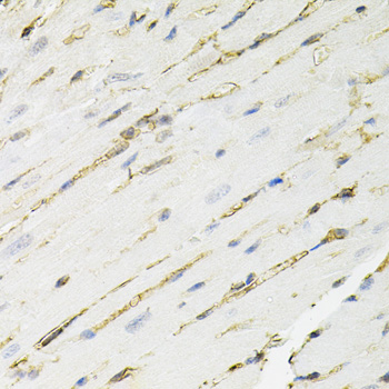 Anti-ANXA2 Antibody [KO Validated] (CAB12397)