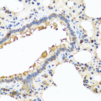 Anti-CHI3L2 Antibody (CAB7654)