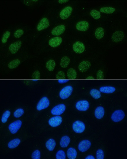 Anti-Phospho-Histone H3-S28 pAb (CABP0839)