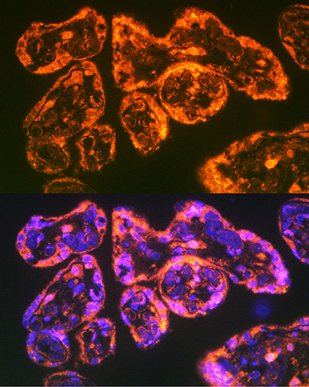 Anti-ITGA5 Antibody (CAB6209)