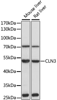 Anti-CLN3 Antibody (CAB1931)