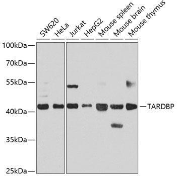 Anti-TARDBP Antibody (CAB13405)