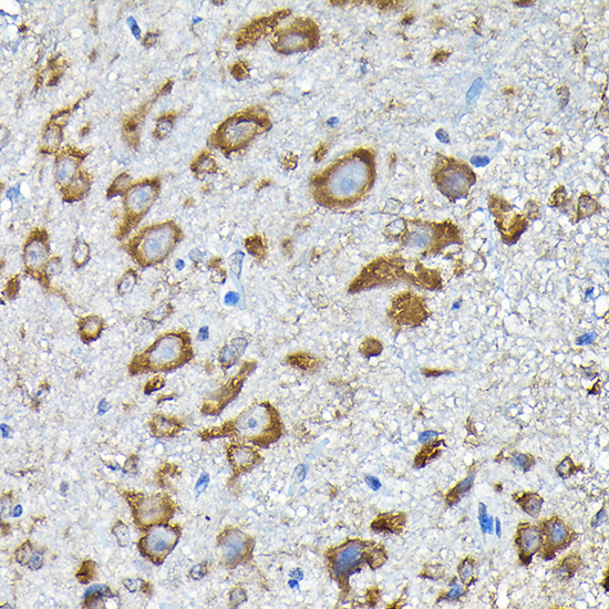 Anti-RPS14 Antibody (CAB6727)