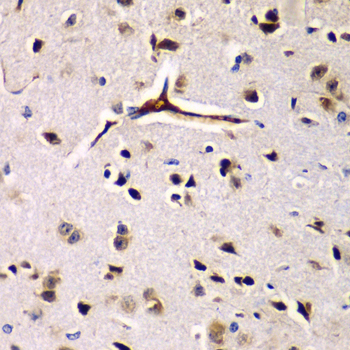 Anti-EIF2AK4 Antibody (CAB7155)