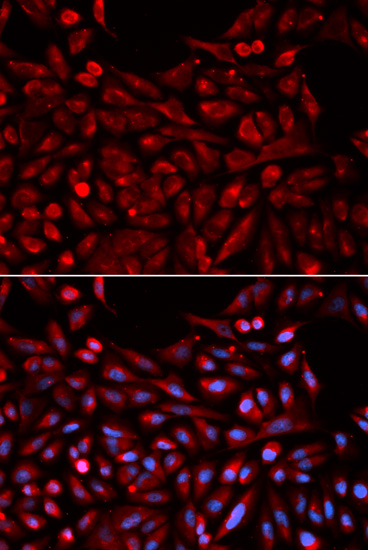 Anti-NR1I3 Antibody (CAB1970)