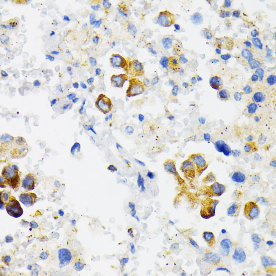 Anti-USO1 Antibody (CAB2796)