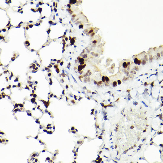 Immunohistochemistry of paraffin-embedded mouse lung using MCM2 Rabbit mAb at dilution of 1:100 (40x lens). Perform high pressure antigen retrieval with 10 mM citrate buffer pH 6. 0 before commencing with IHC staining protocol.