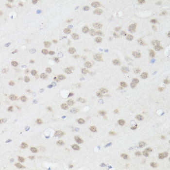 Anti-TIA1 Antibody (CAB6237)