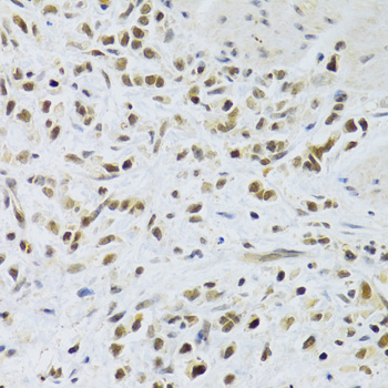 Anti-Rad50 Antibody (CAB0182)