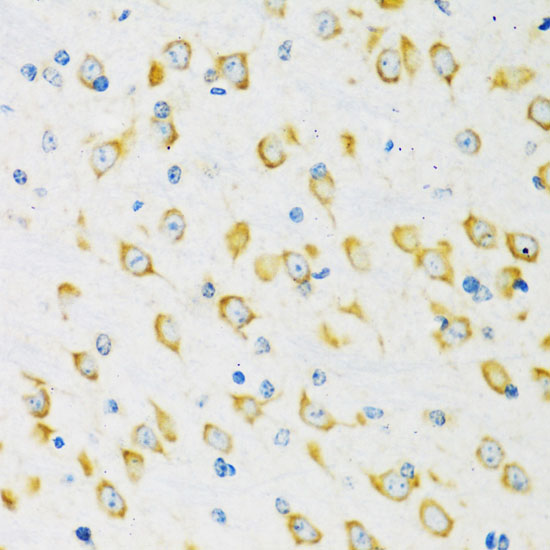 Anti-FMR1 Antibody (CAB6092)