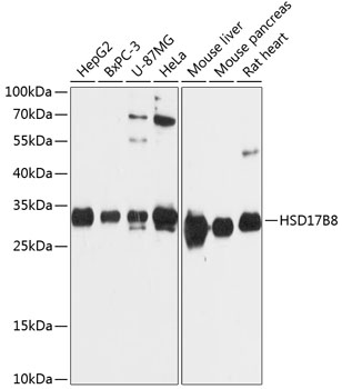 Anti-HSD17B8 Antibody (CAB12947)