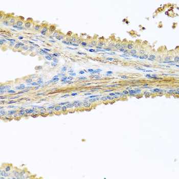 Anti-PIP Antibody (CAB6394)