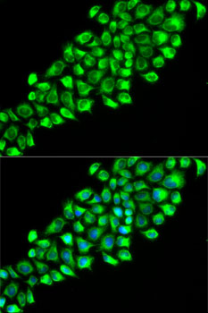 Anti-PON2 Antibody (CAB14048)