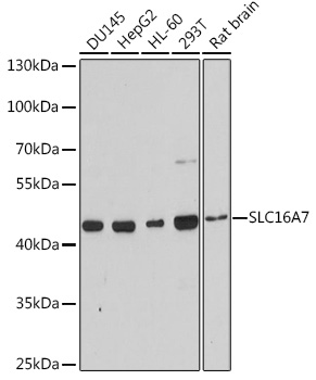 Anti-SLC16A7 Antibody (CAB3015)