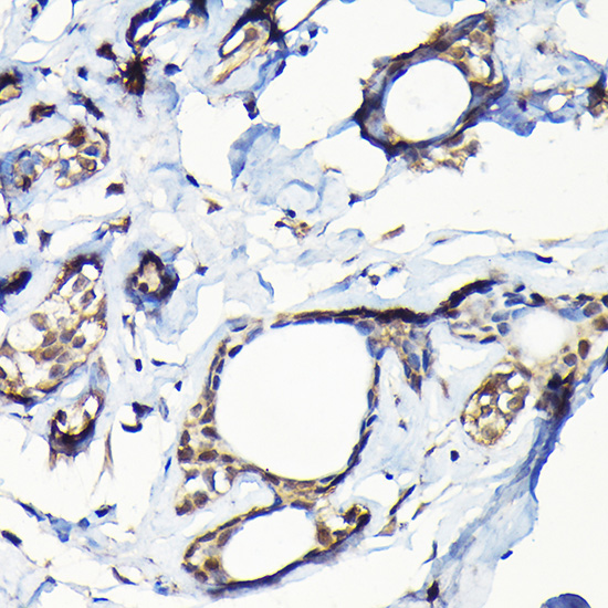 Anti-USP5 Antibody (CAB4202)