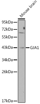 Anti-GJA1 Antibody (CAB2163)